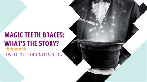 Beauty and Confidence Boost with Magic Teeth Braces